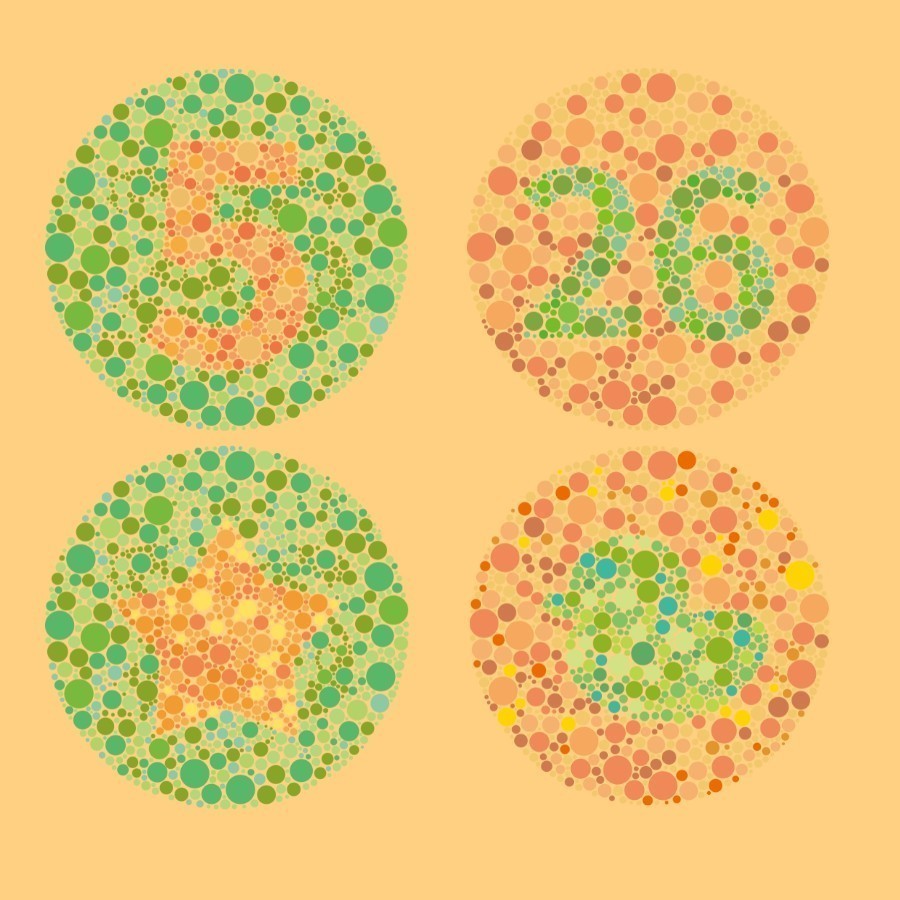 5 cách kiểm tra mắt có bị cận hay không tại nhà, lưu ý khi đo 12 5 cách kiểm tra mắt có bị cận hay không tại nhà, lưu ý khi đo - Ảnh 11