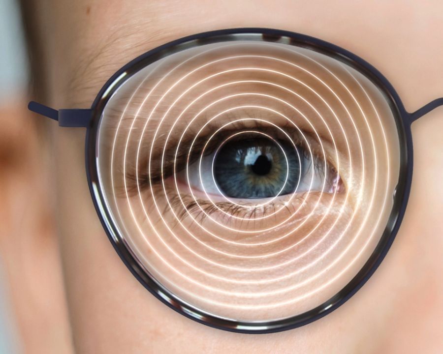 10 các loại tròng kính cận tốt được chuyên gia khuyên dùng 9 Tròng kính dành cho trẻ em Zeiss Myovison Pro